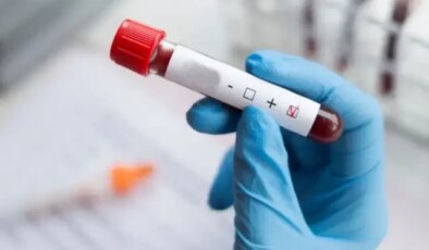Dünyada vakalar azalıyor, Türkiye’de ise HIV artıyor