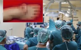 Eşi benzeri olmayan olay! Kulağını 5 ay ayağında taşıdı