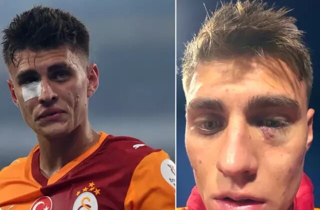 Kazımcan Karataş’a çakmak atan kişi hakkında karar çıktı