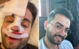 Kadir Ezildi burnu sargılı fotoğrafıyla korkuttu! Gerçek sonradan ortaya çıktı