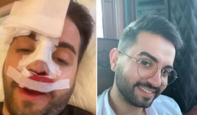 Kadir Ezildi burnu sargılı fotoğrafıyla korkuttu! Gerçek sonradan ortaya çıktı