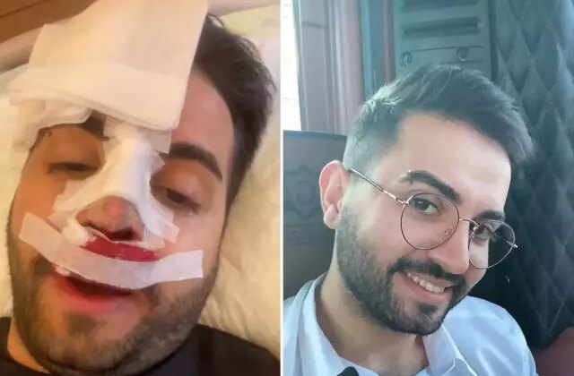 Kadir Ezildi burnu sargılı fotoğrafıyla korkuttu! Gerçek sonradan ortaya çıktı