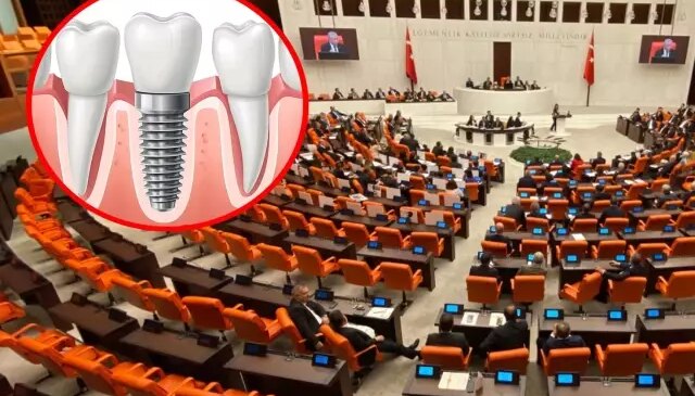 Milyonları ilgilendiren teklif Meclis’e sunuldu! İmplant tedavisi ücretsiz oluyor
