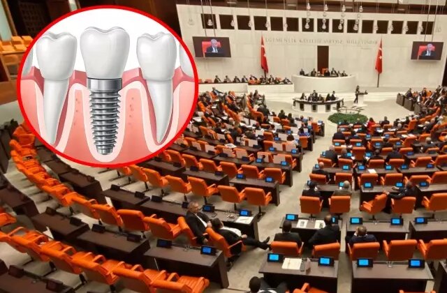 Milyonları ilgilendiren teklif Meclis’e sunuldu! İmplant tedavisi ücretsiz oluyor