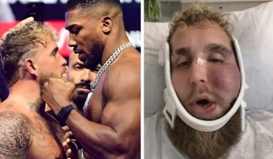 Suratı tanınmaz hale gelen Jake Paul’un ne kadar kazandığını duyunca şok olacaksınız