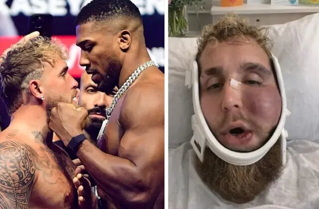 Suratı tanınmaz hale gelen Jake Paul’un ne kadar kazandığını duyunca şok olacaksınız