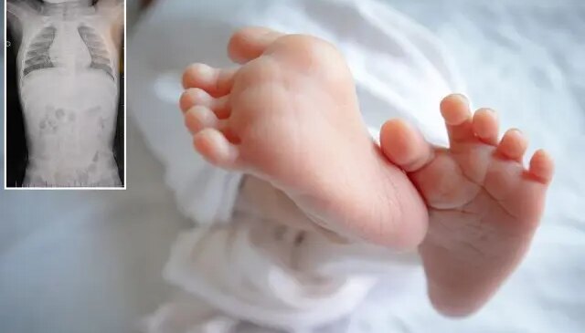 1 yaşındaki bebek sırtüstü yatırılınca hep ağladı! Gerçeği öğrenen aile şoke oldu