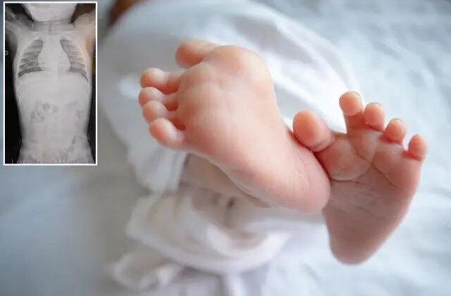 1 yaşındaki bebek sırtüstü yatırılınca hep ağladı! Gerçeği öğrenen aile şoke oldu