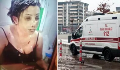 Bunun adı saf kötülük! Eşini koli bandıyla bağlayıp kezzapla yaktı