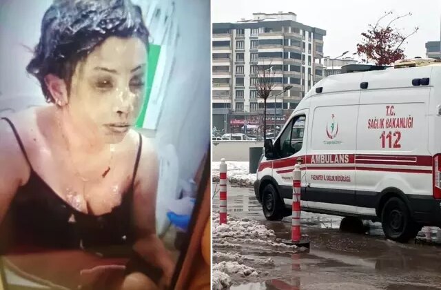 Bunun adı saf kötülük! Eşini koli bandıyla bağlayıp kezzapla yaktı