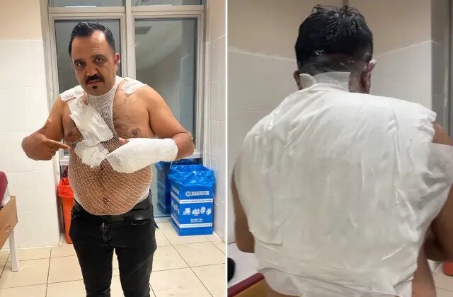 Deney yapmak isterken hayatının hatasını yaptı