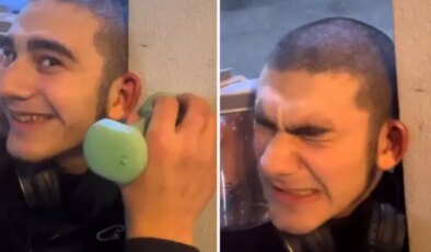 Dövüşçülere benzemek için kulak kıkırdaklarını kırdırdı