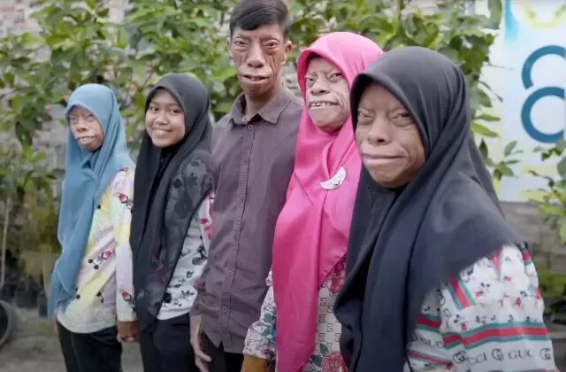 Dünya onları konuşuyor! “Kertenkele Ailesi” kısa sürede fenomen oldu