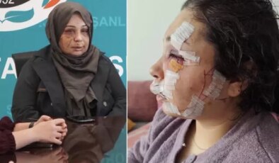 Eşini bu hale getiren Cumhurbaşkanı Koruma Dairesi personeli tutuklandı