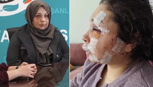 Eşini bu hale getiren Cumhurbaşkanı Koruma Dairesi personeli tutuklandı