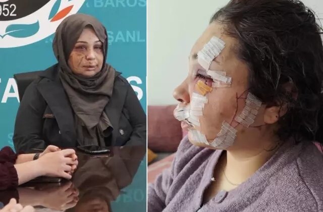 Eşini bu hale getiren Cumhurbaşkanı Koruma Dairesi personeli tutuklandı