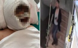 Eski eşini kezzapla ağır yaralayan adam her şeyi önceden planlamış