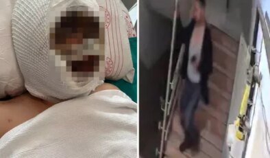 Eski eşini kezzapla ağır yaralayan adam her şeyi önceden planlamış