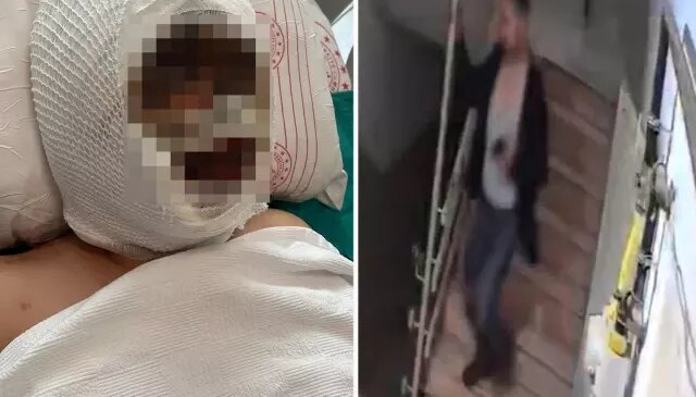Eski eşini kezzapla ağır yaralayan adam her şeyi önceden planlamış