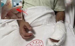 Herkesin evinde bulunan tehlike! Vücudunun yüzde 30’u yandı