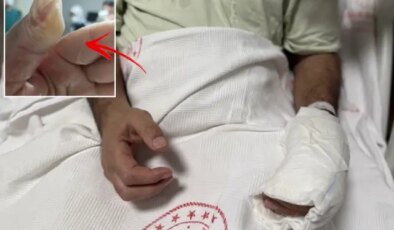 Herkesin evinde bulunan tehlike! Vücudunun yüzde 30’u yandı