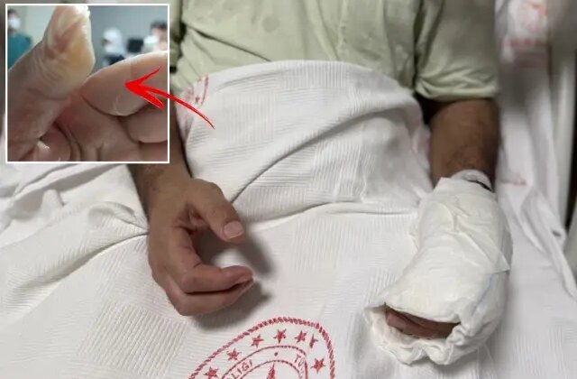 Herkesin evinde bulunan tehlike! Vücudunun yüzde 30’u yandı