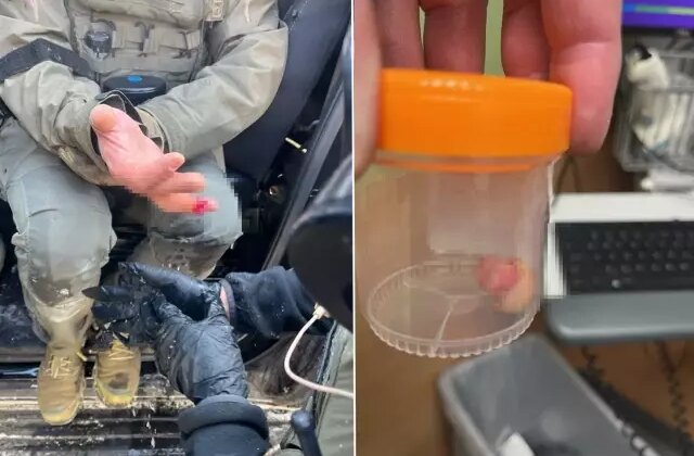 ICE karşıtı protestolarda şoke eden iddia: Görevlinin parmağını ısırarak kopardılar