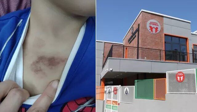 Kreşte taciz soruşturmasında mağdur çocuğun ifadesi: Bir arkadaşımı dövdü, elbisemi indirip çıplakken kameraya çekti