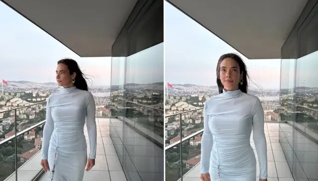 Müge Boz, 20 yıldır mücadele ettiği sedef hastalığını açıkladı