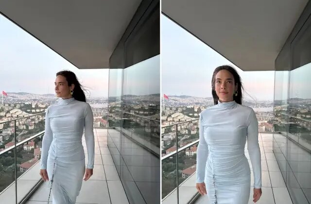 Müge Boz, 20 yıldır mücadele ettiği sedef hastalığını açıkladı