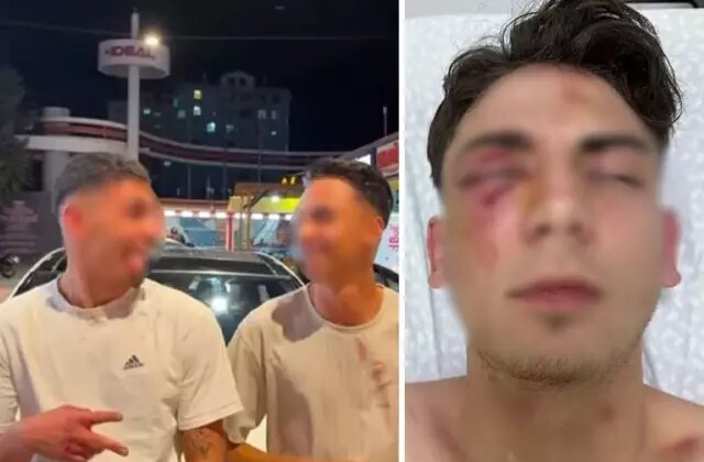 Muştalarla döverek kör ettiler, ellerinde kan ile video çektiler! 1,5 ayda tahliye olan şüpheliler yeniden gözaltında