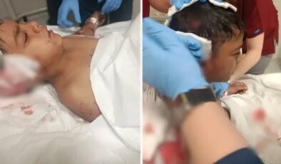 Okul çıkışı sokak köpeklerinin saldırdığı Davut yaralandı