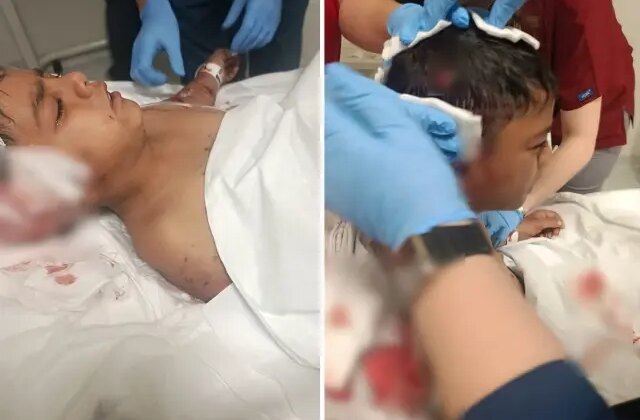 Okul çıkışı sokak köpeklerinin saldırdığı Davut yaralandı