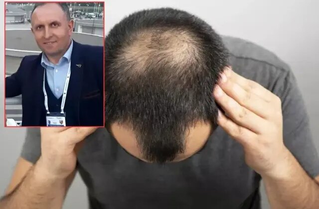 Saç ekimi sırasında fenalaştı, hayatını kaybetti