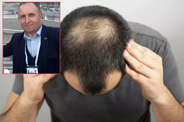 sac ekimi sirasinda fenalasti hayatini kaybetti 19440564 1894 o