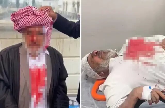 Şanlıurfa’da sopayla darba 4 tutuklama