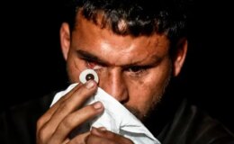 Savaşta iki kez yaralandı, gözlerini kaybetti