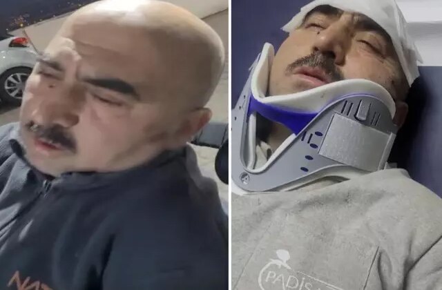 Sigortasız çalıştırılan işçiye patron ve oğlundan öldüresiye dayak