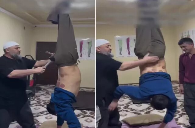 Tedavi değil işkence! Ayaklarından tavana asıp çekiç ve kazıkla…