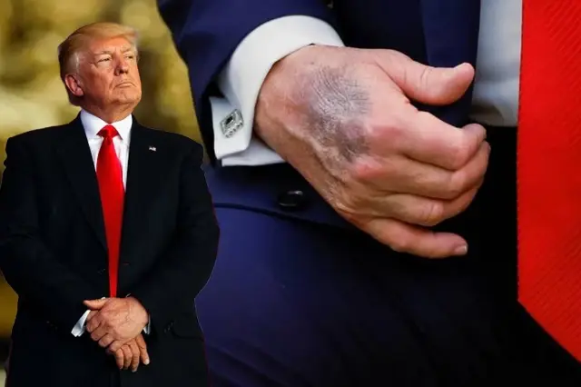 trump elindeki morlugun nedeni acikladi 19493737 4977 o