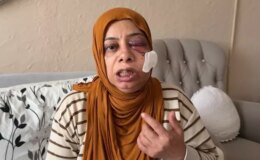 Akraba ziyaretine giderken bu hale geldi