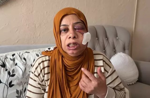 Akraba ziyaretine giderken bu hale geldi