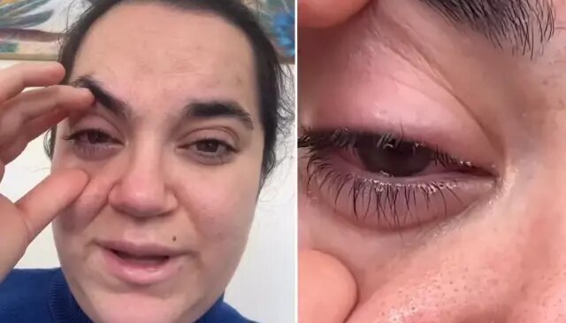 Bulaşık makinesi tableti kadının gözüne patladı, kör olma korkusu yaşadı