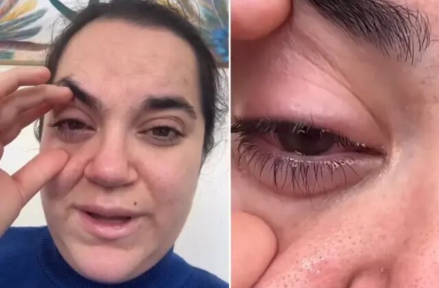 Bulaşık makinesi tableti kadının gözüne patladı, kör olma korkusu yaşadı