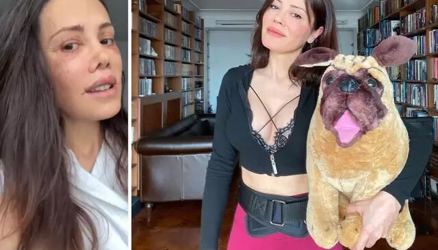 Didem Ceran, yüz estetiği sonrası 19 gündür banyo yapmadığını açıkladı