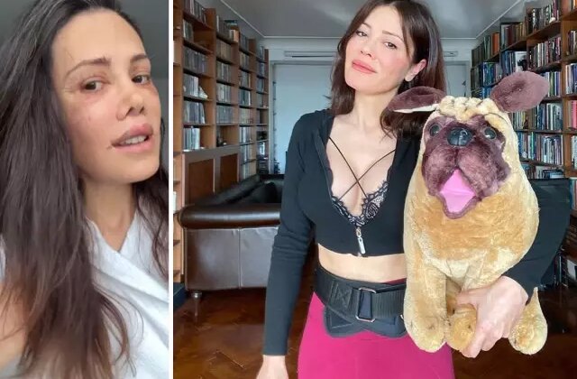 Didem Ceran, yüz estetiği sonrası 19 gündür banyo yapmadığını açıkladı