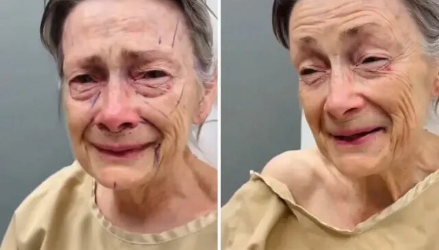 Estetik operasyonu sonrası geçirdiği değişim inanılmaz