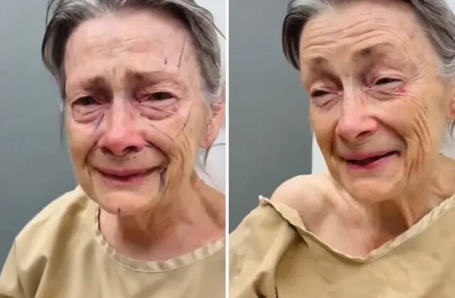 Estetik operasyonu sonrası geçirdiği değişim inanılmaz