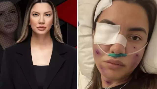 Fulya Öztürk trafik kazası mı geçirdi? Elden ele dolaşan görselle ilgili açıklama var