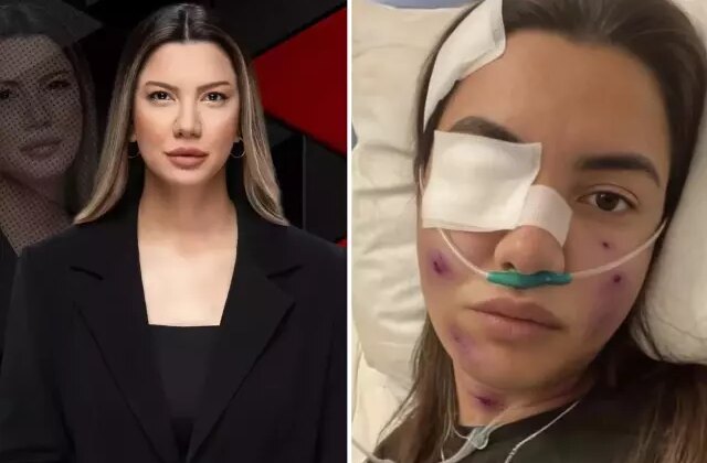 Fulya Öztürk trafik kazası mı geçirdi? Elden ele dolaşan görselle ilgili açıklama var